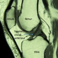 Ligaments du genou img Ligaments du genou