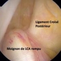 Ligaments du genou img Ligaments du genou