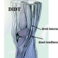 Ligaments du genou img Ligaments du genou