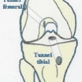 Ligaments du genou img Ligaments du genou