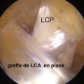 Ligaments du genou img Ligaments du genou